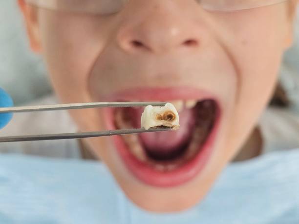 Best Emergency Tooth Extraction  in Holiday City South, NJ